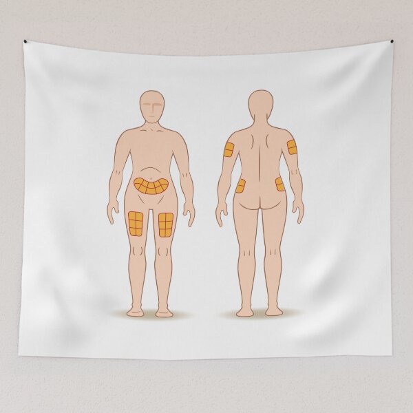 Item preview, Guide for application of a caster injection into a person, back, thigh, shoulder, belly, and may be for the treatment of diabetes or sclerosis designed and sold by LucianoCosmo.
