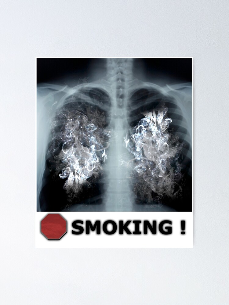 "Stop Smoking Xray" Poster for Sale by jenterpixels Redbubble