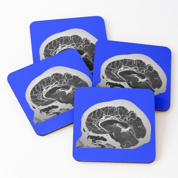Item preview, Sagittal Cerebral Angiography Image designed and sold by Creative Endeavors ..
