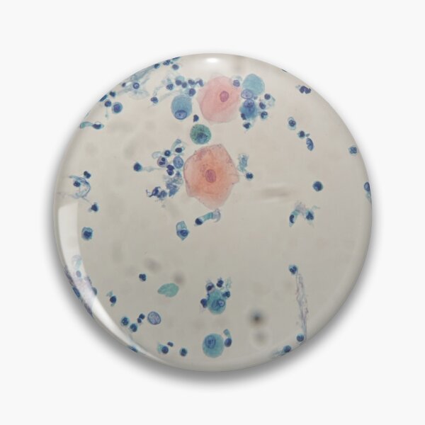 Item preview, Diagnostic Cytology - bronchoalceolar lavage designed and sold by CellPathWorld.
