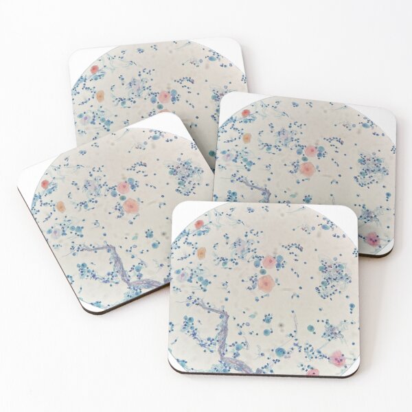 Item preview, Diagnostic Cytology - bronchoalceolar lavage designed and sold by CellPathWorld.