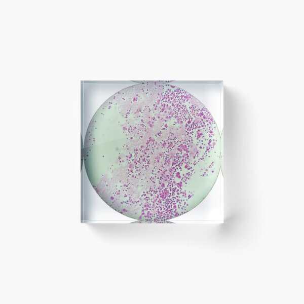 Item preview, Cell block of a pleural fluid designed and sold by CellPathWorld.