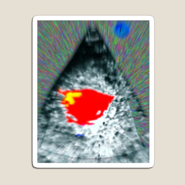 Aperçu de l'œuvre Échocardiogramme Modifier créée et vendue par Spaghetti13.