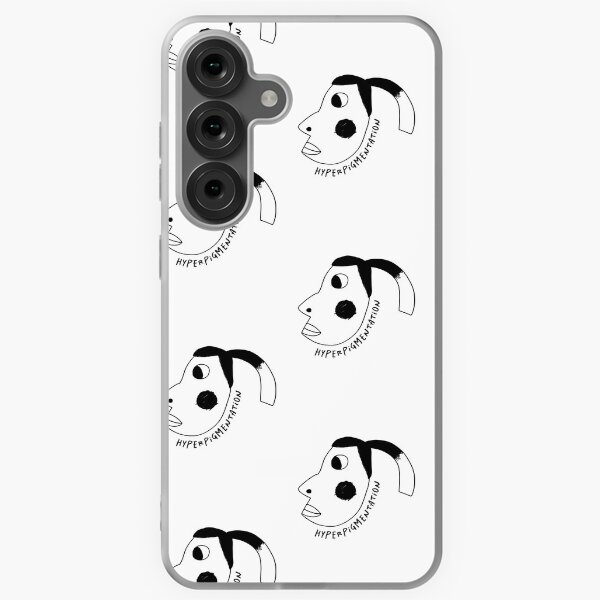 Funny Hyperpigmentation Samsung Galaxy Soft Case