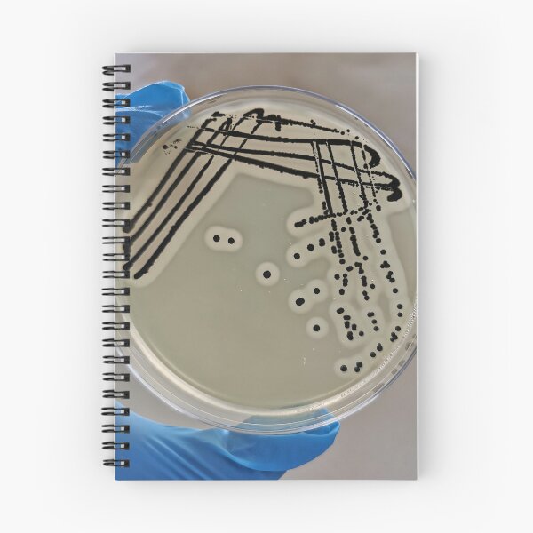 Item preview, Quadrant Streak of Staphylococcus aureus designed and sold by NandaniBridglal.