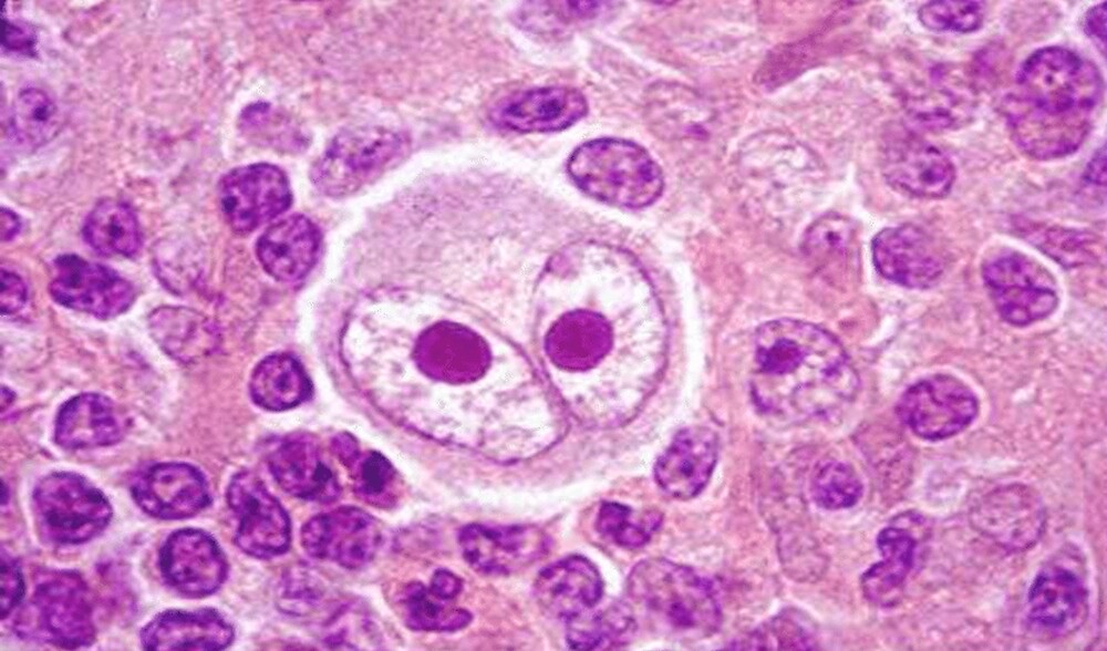 "Reed Sternberg" by DarkiraVClemm Redbubble