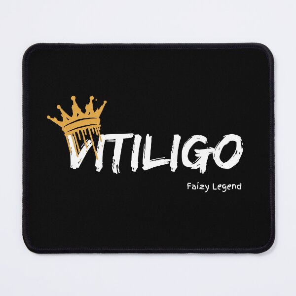 Item preview, Vitiligo King - Faizy Legend designed and sold by FaizyLegend.