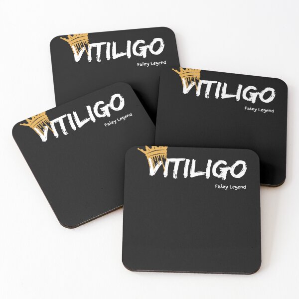 Item preview, Vitiligo King - Faizy Legend designed and sold by FaizyLegend.