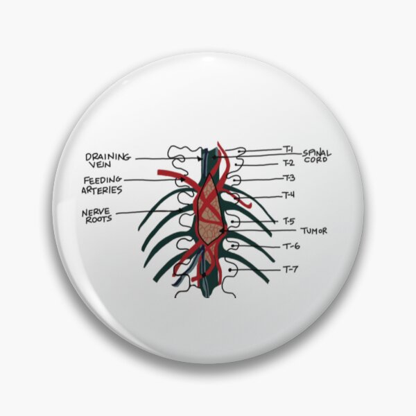Item preview, Derek’s Famous Brain Tumor designed and sold by coolingsummers.