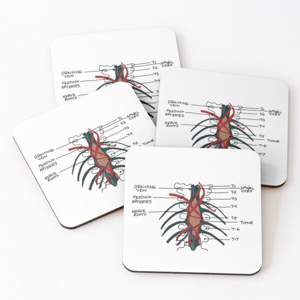 Item preview, Derek’s Famous Brain Tumor designed and sold by coolingsummers.