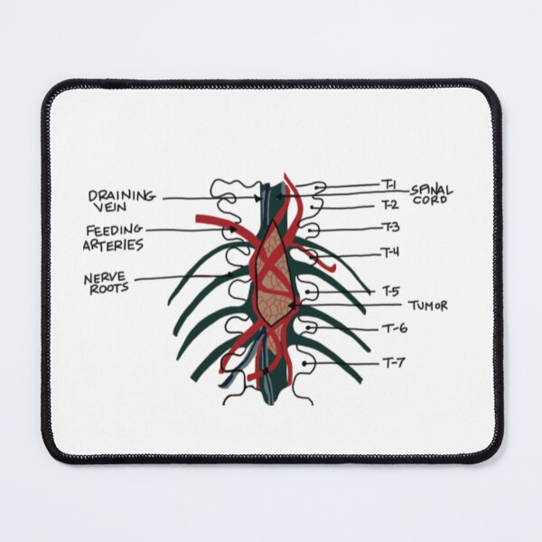 Item preview, Derek’s Famous Brain Tumor designed and sold by coolingsummers.