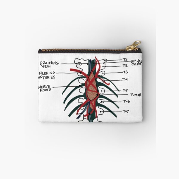 Item preview, Derek’s Famous Brain Tumor designed and sold by coolingsummers.
