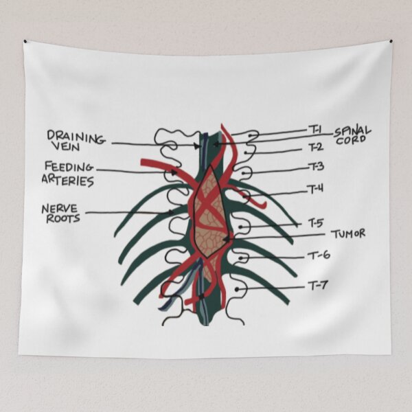 Item preview, Derek’s Famous Brain Tumor designed and sold by coolingsummers.