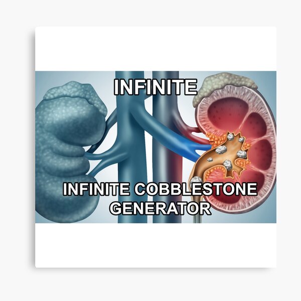 Item preview, Infinite Cobblestone generator designed and sold by AtelierJamie.