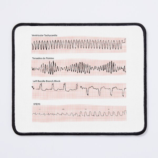Artikelvorschau, EKG-Rhythmen entworfen und verkauft von Spilled--Ink.