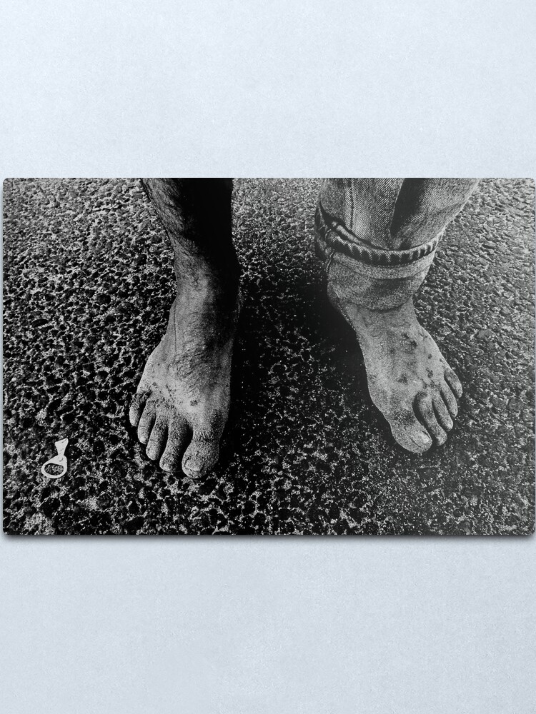 Alternate view of Feet of an Italian Metal Print