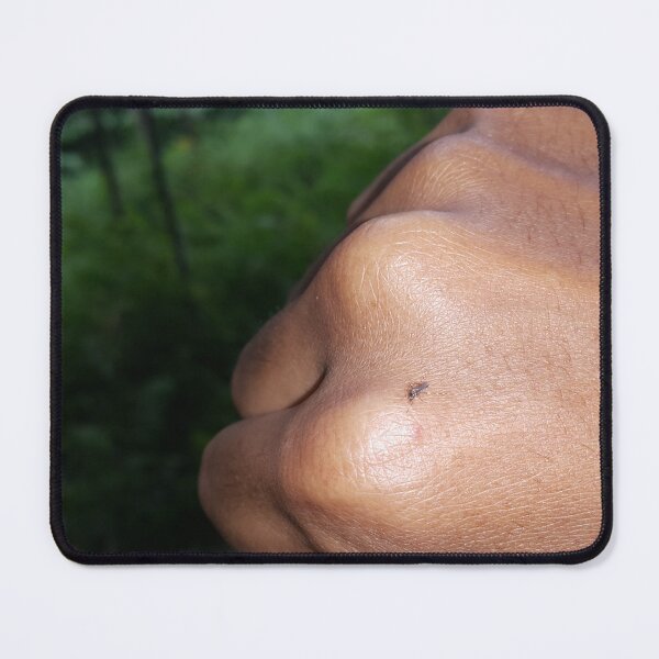 Item preview, Mosquito sitting on her hand and drinks the blood of the pierced skin. designed and sold by Yusuf-Design.