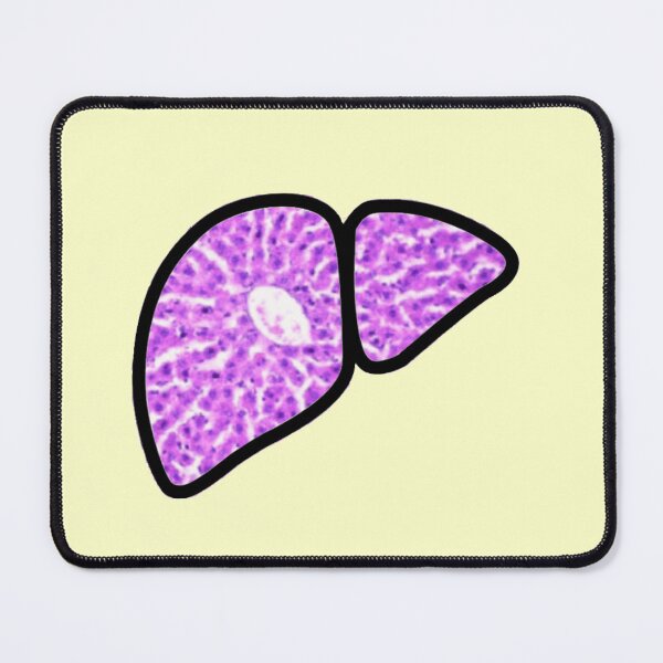 Item preview, Liver Histology Microscopy Transplant Liver Disease Hepatitis Sticker designed and sold by LethallyBlonde.