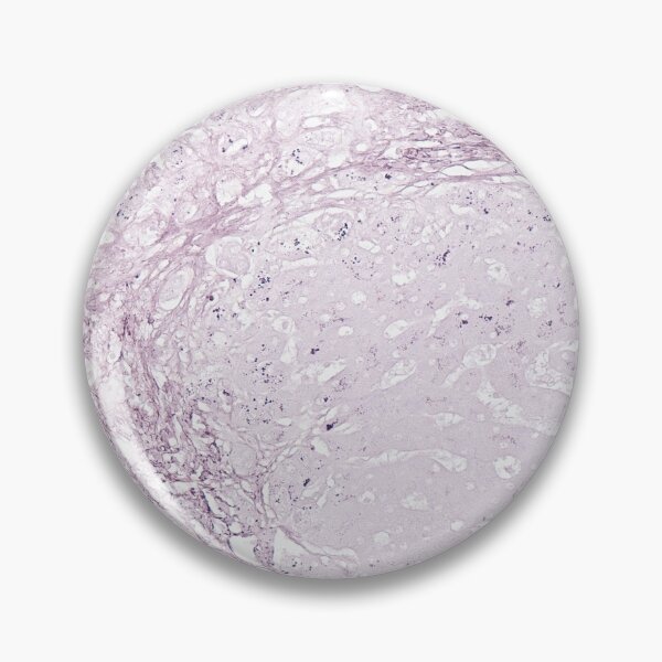 Item preview, Orcein special stain in liver core (copper pigments) designed and sold by CellPathWorld.