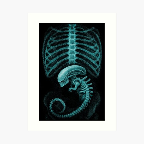 aps,504x498,large,transparent-