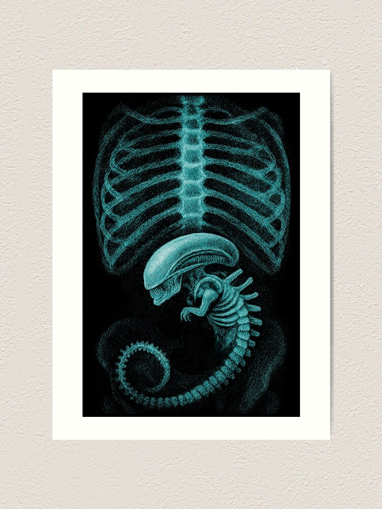 Alien radiography, Alien X-ray