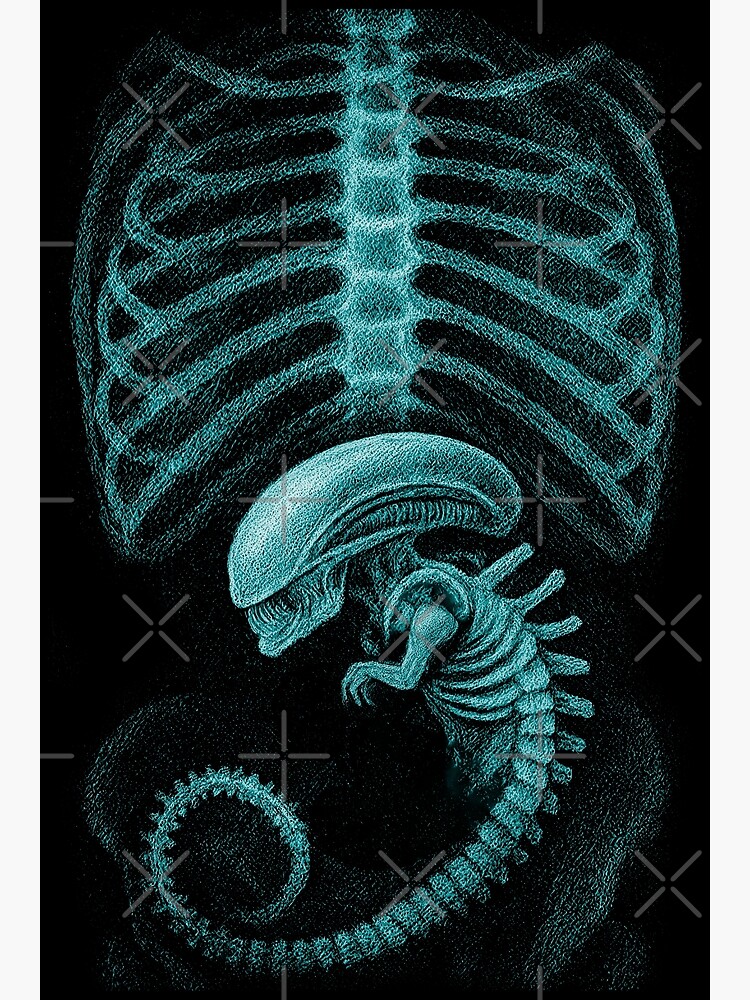 Alien radiography, Alien X-ray