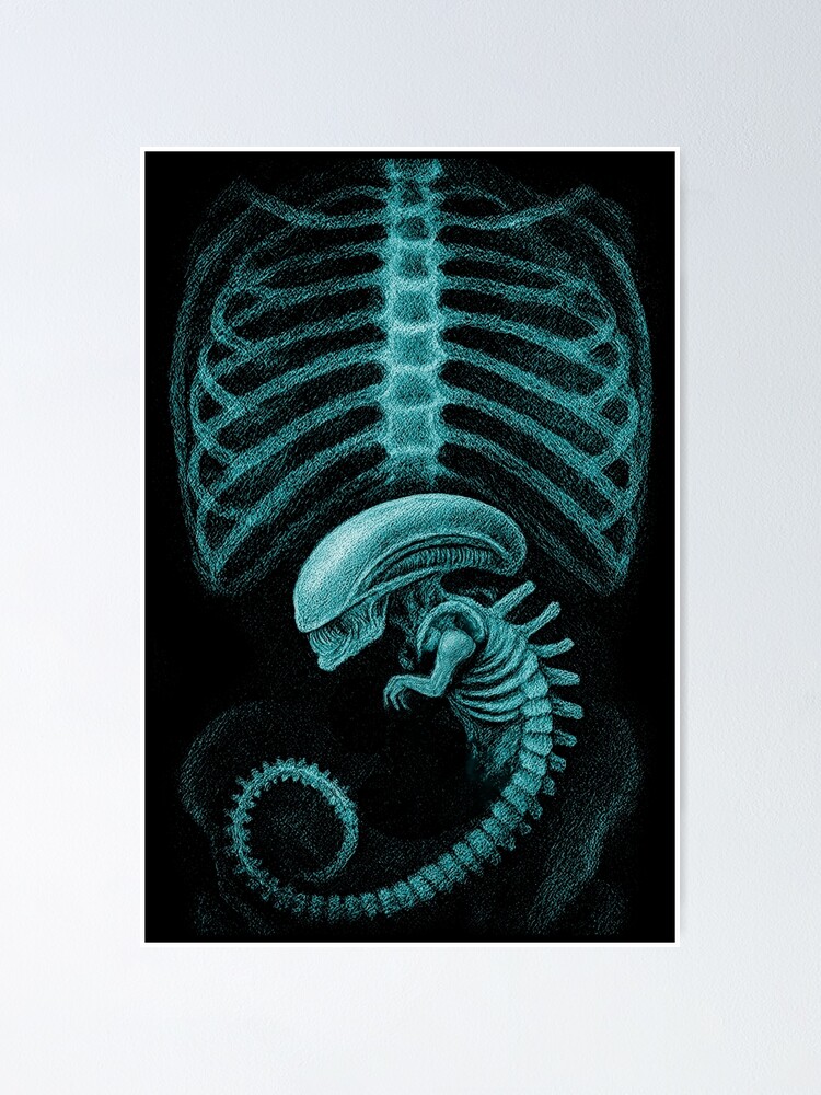 Alien radiography, Alien X-ray