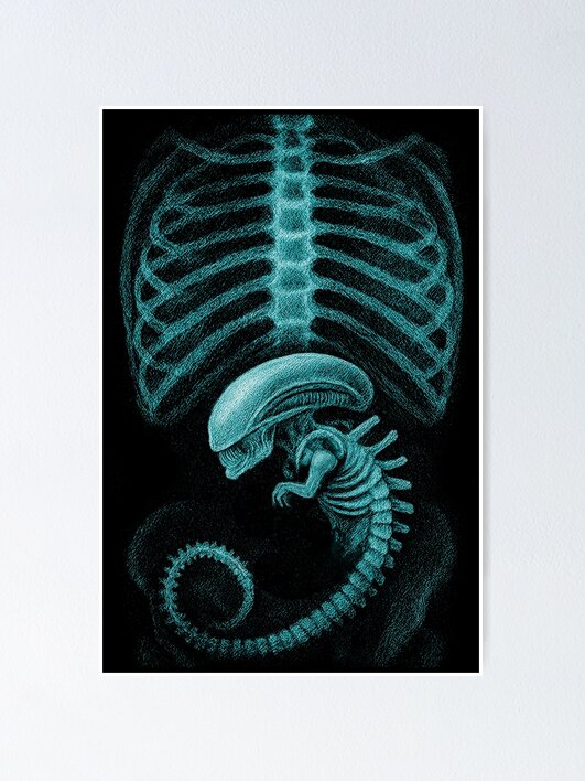 Alien radiography, Alien X-ray