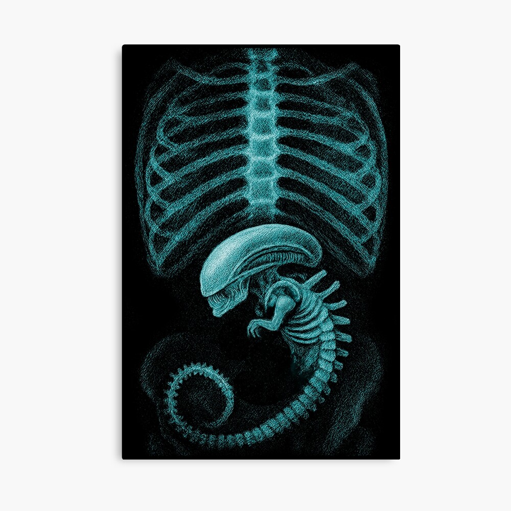 Alien radiography, Alien X-ray