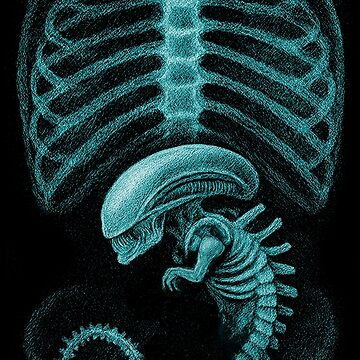 Alien radiography, Alien X-ray