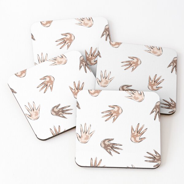 Item preview, Vitiligo People Tribute designed and sold by KaramfilaS.