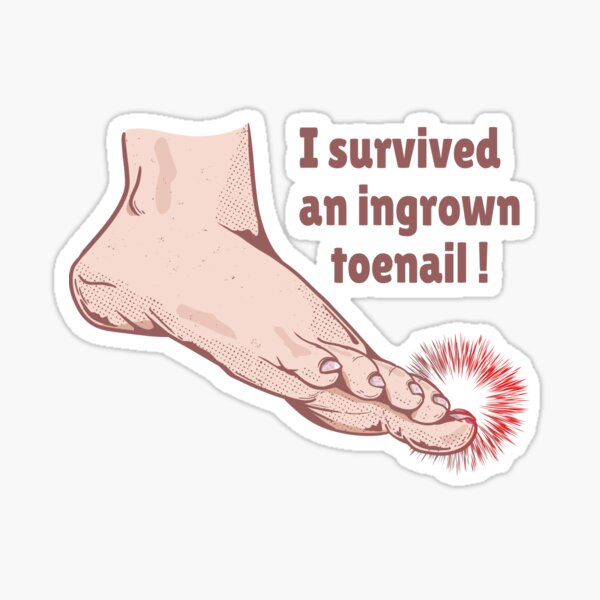 Item preview, I survived an ingrown toenail designed and sold by LICENSEDLEGIT.