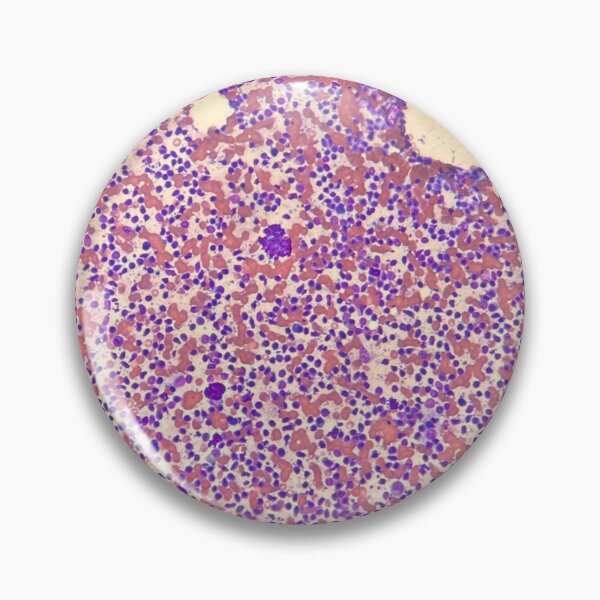 Item preview, Cytology FNA Giemsa stain designed and sold by CellPathWorld.