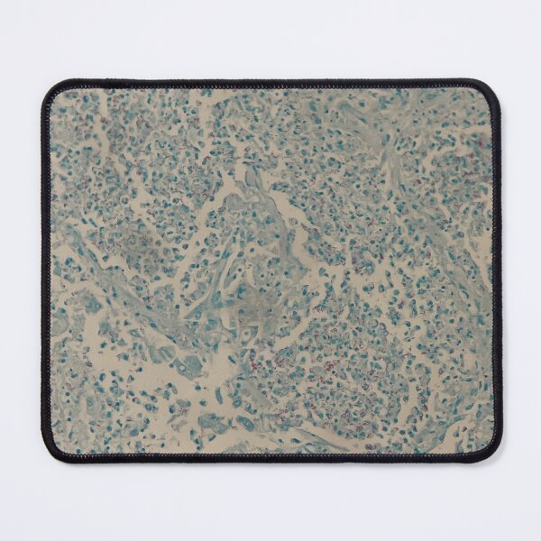 Item preview, ZN special stain designed and sold by CellPathWorld.