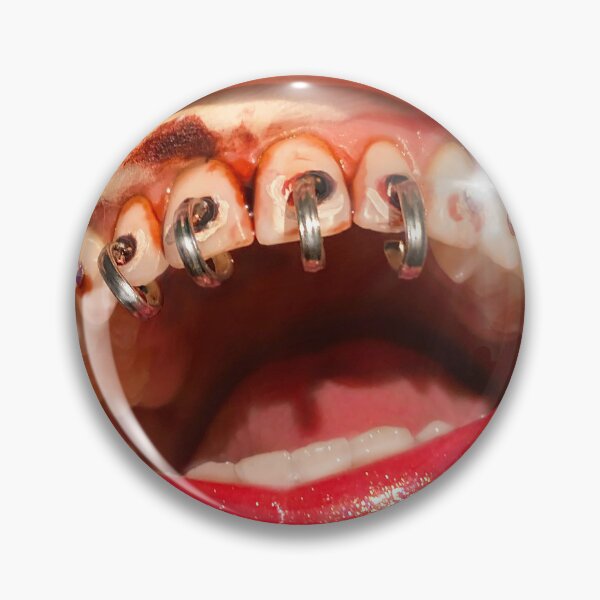 Item preview, Toothoops designed and sold by McKennaJBailey.