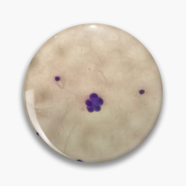 Item preview, Giemsa stain flowers (pleural fluid) designed and sold by CellPathWorld.