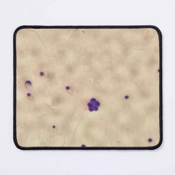 Item preview, Giemsa stain flowers (pleural fluid) designed and sold by CellPathWorld.