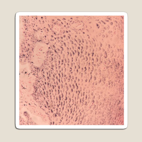 Item preview, Sand waves (Fontana Masson special stain) skin designed and sold by CellPathWorld.