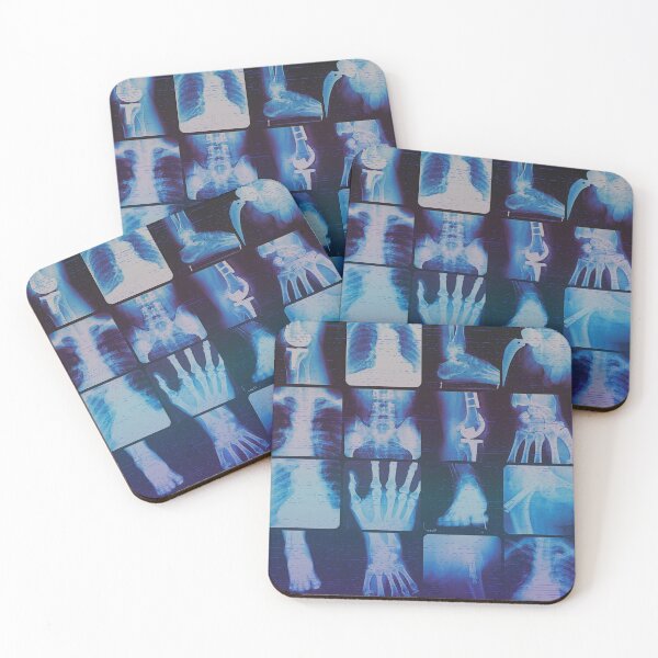 Item preview, XRAY SPEX designed and sold by PitchBlackIcon.