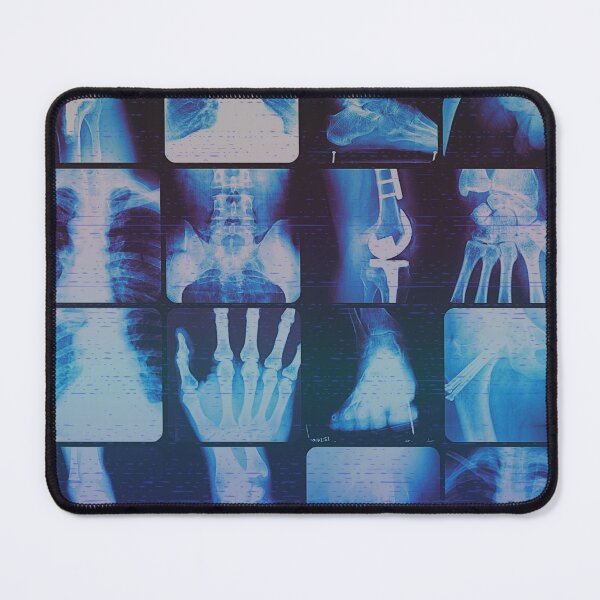 Item preview, XRAY SPEX designed and sold by PitchBlackIcon.