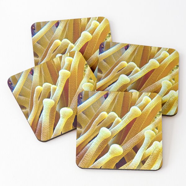 Item preview, Golden Tips: The Anemone’s Secret designed and sold by SeaLensStudio.