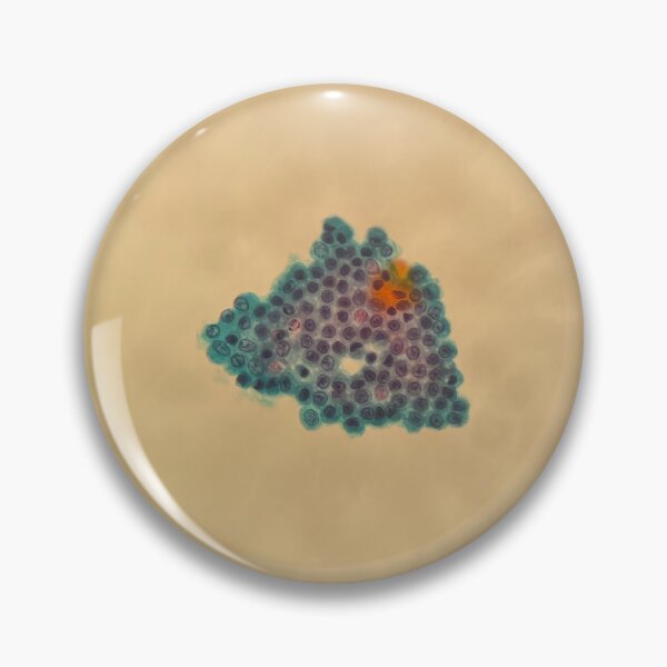 Item preview, Peritoneal fluid - sheet of cells designed and sold by CellPathWorld.