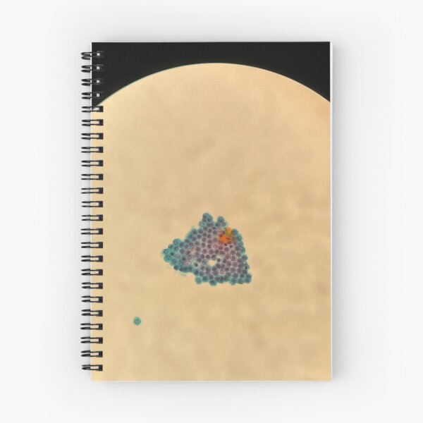 Item preview, Peritoneal fluid - sheet of cells designed and sold by CellPathWorld.