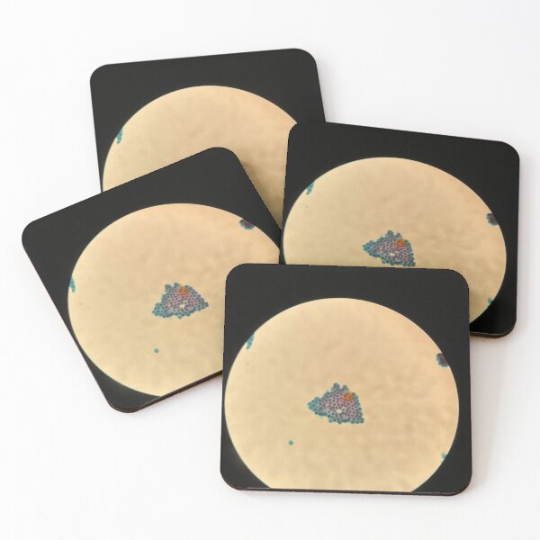 Item preview, Peritoneal fluid - sheet of cells designed and sold by CellPathWorld.