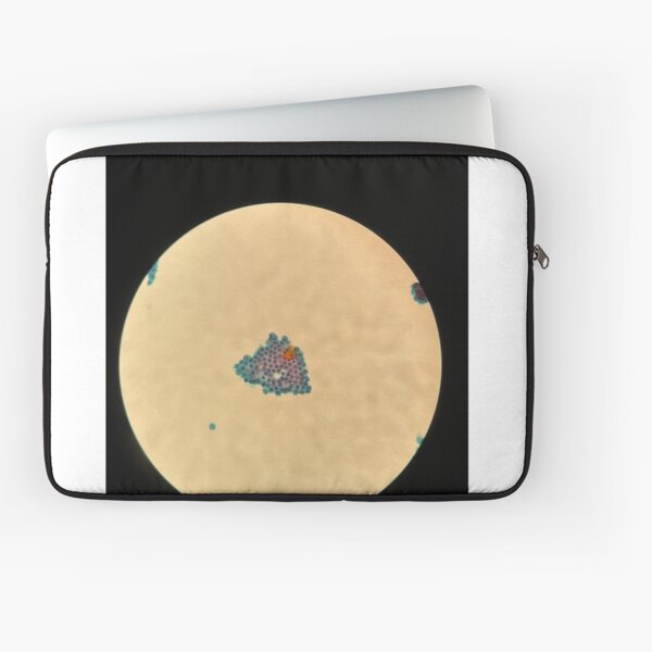 Item preview, Peritoneal fluid - sheet of cells designed and sold by CellPathWorld.