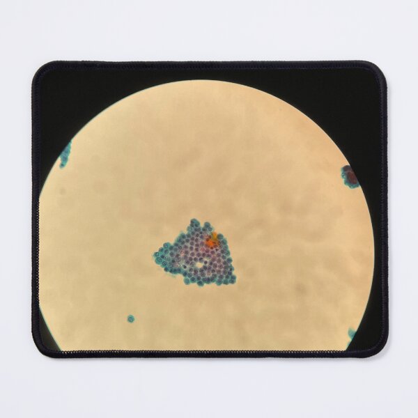Item preview, Peritoneal fluid - sheet of cells designed and sold by CellPathWorld.