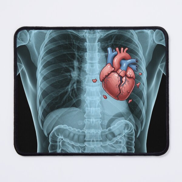 Item preview, X Ray series: "Broken heart" designed and sold by HouseofRome.
