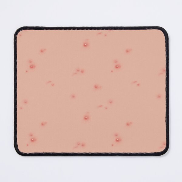 Item preview, Pop off! Pimple, zits, acne designed and sold by Joan and Rose.