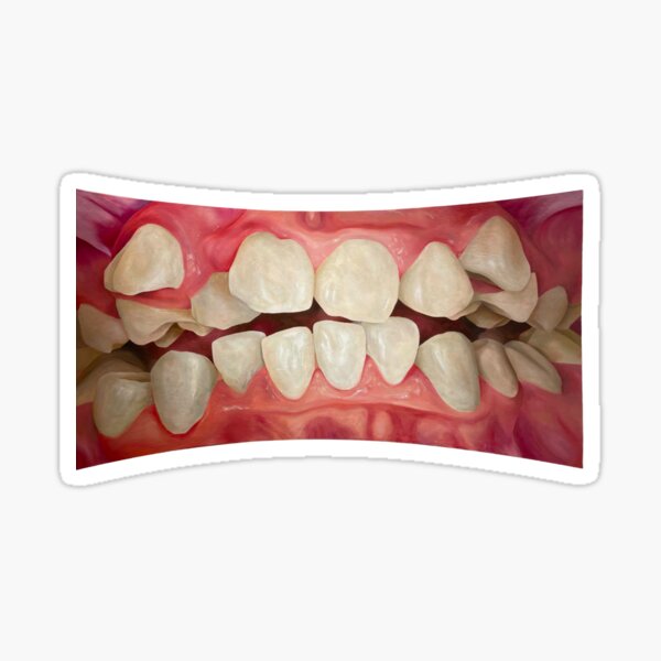 Item preview, Genuine Smile designed and sold by efergusonnart.