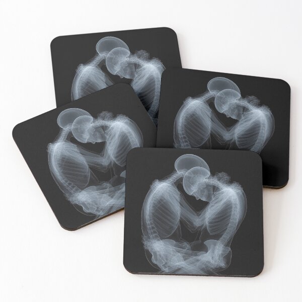Item preview, XRay embrace designed and sold by Brendon987.
